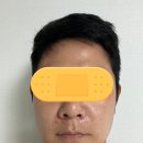 신사역피부과 스킨부스터 콜라스터 후기