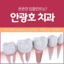 안광호치과의원 | 둔산동임플란트 편안한 사용