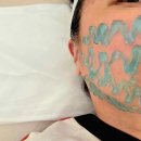 라온핏 | 평택윤곽관리 얼굴비대칭 전후 리얼 후기 밀도뷰티랩│평택웨딩관리