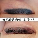 마가제이뷰티 | 파주 운정 반영구 아이라인 제거/아이라인 문신 지우는 곳 마가제이뷰티