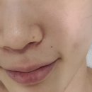 정원장의 모공세척테라피 이미지