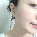 아이노스피부 네이버블로그