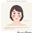 (피부) 힘들었던 얼굴 피부염, 완치까지의 피부일기 1