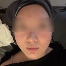 강남 피부과 홍조 클라리티 + 레프톤리프팅 후기