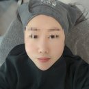 안의원 | 신사역피부과 온다리프팅 내돈내산 후기 [로렌의원]추천