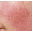 소망피부과의원 | 화성봉담피부과 선택기준 (진료과목:피부과)