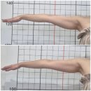 더원헬스케어 | [강북/미아/수유] 팔뚝살 뿌시기 프로젝트 : 더원뷰티 슬리밍 관리