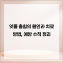 강창더좋은치과의원 | 한 번이 두번이 되는 잇몸 출혈의 시작, 늦지않게 알아보세요 - 잇몸 출혈의 원인과 치료 방법, 예방...