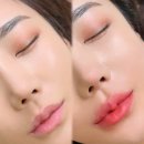 링링브로우 이미지