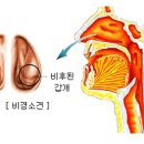 비후성 비염[hypertrophic rhinitis] 이미지