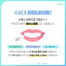 스마일 라인 치과기공소 이미지