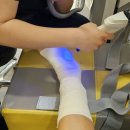 정성정형외과의원 | 발목인대봉합술(MBO) 후기 2 :: 영통 정성정형외과 수술, 2박3일 입원