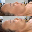루시아 피부관리