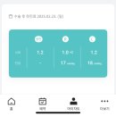 강남 비앤빛안과 렌즈삽입술 열흘차 내돈내산 후기+지인할인정보