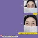 래쉬더로즈 이미지