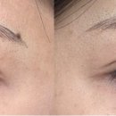 아인뷰티랩 인천구월 어나더블랙 이미지