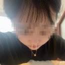 경동한의원 | 알레르기비염 경동시장 근처 한의원 배농치료 후기