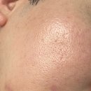 청담아이비성형외과의원 이미지