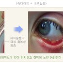 자연치유 이미지