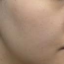 [뷰티] 더마라인 디렉소 NAD 파워 솔루션 앰플 후기, 피부에 생기 더하는 데일리 앰플