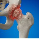 올바른마디튼튼의원 이미지