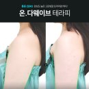 에스테틱고운