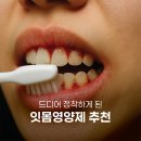 치과 가기 전에 이것부터.. 수술비 500만원 아낀 잇몸영양제 후기 2+1 링크 공유