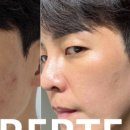 퓨어르떼(PURERTE) 네이버블로그