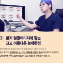 강남 트임성형외과 더웨이의 원데이밑트임가격 후기가 남다르네!