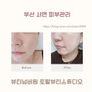 삼정카 토탈 써비스 | 서면피부관리 받고 바로 물광 뷰티넘버원 토탈뷰티스튜디오 여배우 물광필링 후기