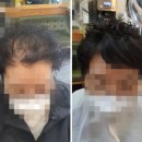 아이리스가발 파주점