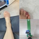 [맛집]부산에서 상륙한 '거대곰탕 서초점' 후기 (Feat.에프킬라를 조심~발가락 깁스 엔딩)