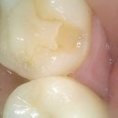 순치과기공소 이미지