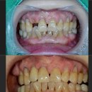 다올치과기공소 이미지