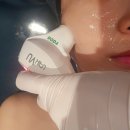 서윤피부맑음 명동점 | 광화문 피부관리 서윤피부맑음 명동점 울쎄라 리프팅 윤곽관리 후기