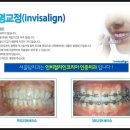 서울탑치과 이미지