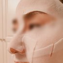 가론에스테틱에서 스킨플래닝, 세멘시트 받고 온 내 돈 내산 솔직 후기