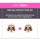 잘하는성형외과 네이버블로그