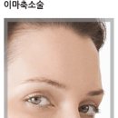 이마 이미지