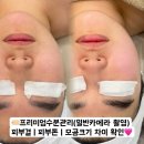 미니뷰티 이미지