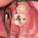 애플치과기공소 이미지