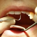 (HL-의학/건강/운동) Drug Helps Teeth Repair Themselves 이미지