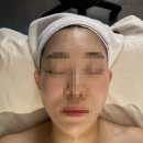 이지 케어 | [신사 피부관리] 붓기 쏙! 광채 뿜뿜 '이지윤곽케어' 후기 (신사 이지슬림 스파)