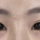디하릐(die Haare)