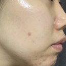 스킨모아 | 로우라이즈 스킨 리페어 세럼 후기