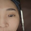 바른선 테라피 이미지