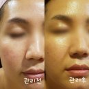 통영 피부관리 꼼꼼한 맞춤관리로 감동받았어요 무전동 자아연에스테틱