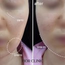 피오르의원 이미지