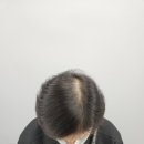 스칼프 메이크업