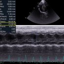 고양이 HCM, RCM, DCM, ARVC 케이스 (1) 이미지